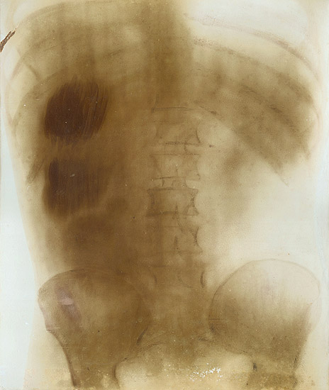Prof. Contremoulin - Large X-Ray of a Torso